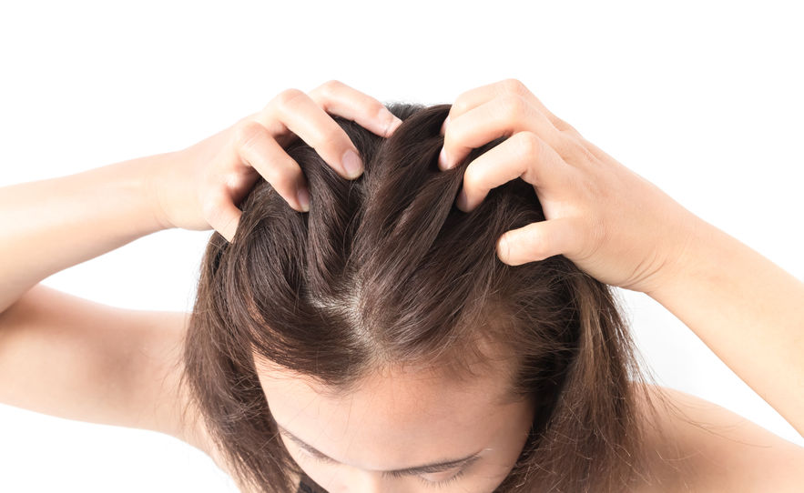 Say Goodbye to Dry Itchy Scalp  Thick hair remedies Itchy scalp Dry  hair